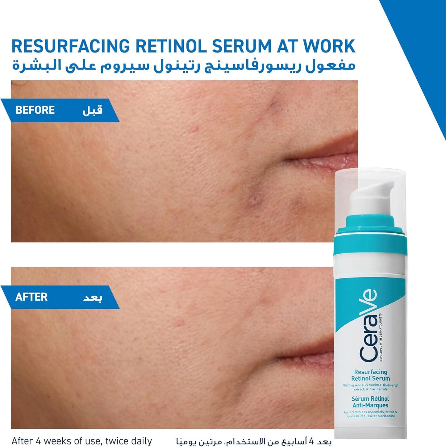 CERAVE RESURFACING RETINOL SERUM TO REDUCE THE APPEARANCE OF POST-ACNE MARKS AND PORES WITH RETINOL, LICORICE ROOT EXTRACT & NIACINAMIDE 30ML